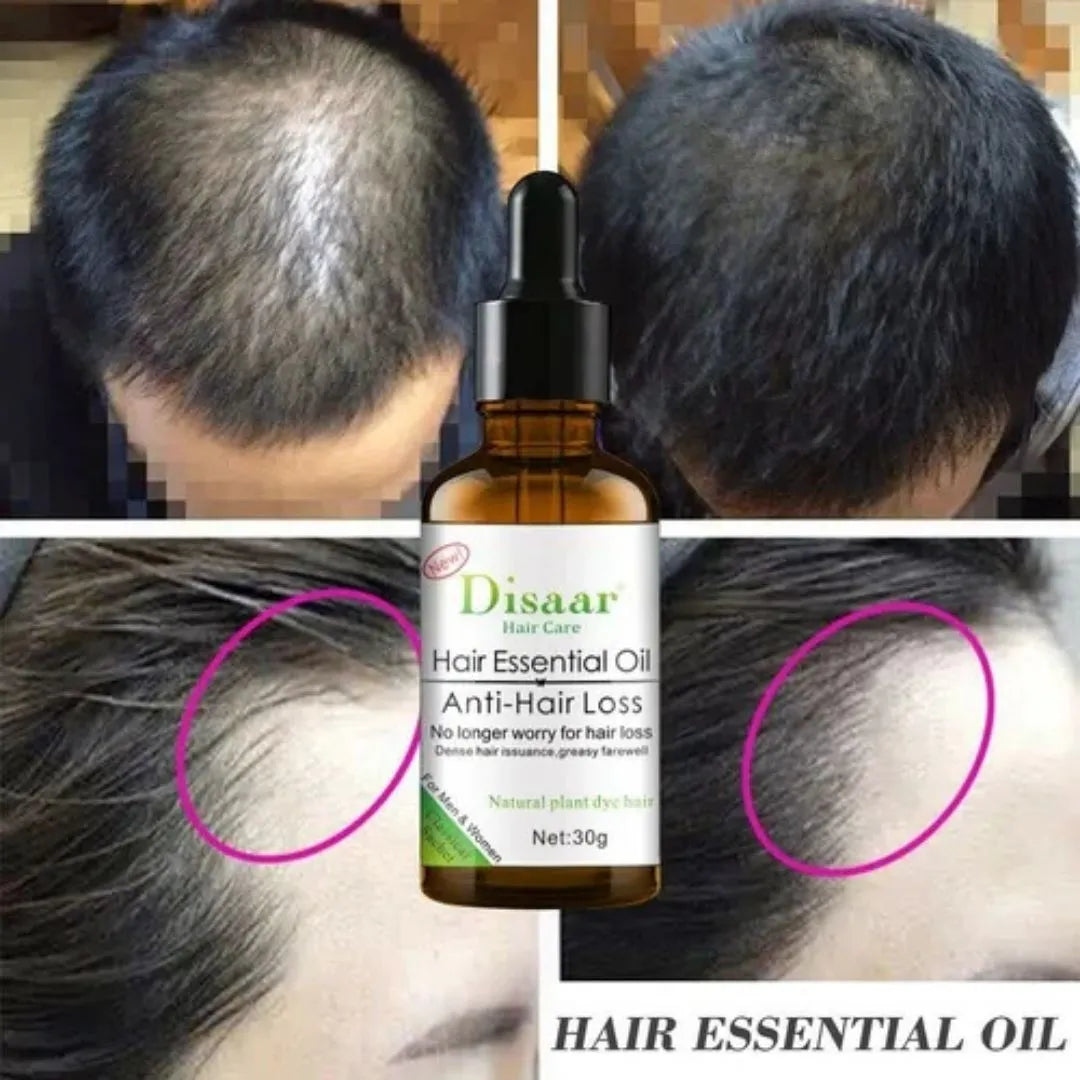 💚 SERUM REVITALIZADOR ANTICAÍDA ✨👩‍🦱