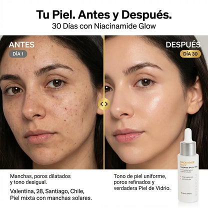 Sérum Coreano con Niacinamida – Piel de Cristal en 30 días