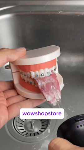 💧🦷 HydroBlast Dental ⚠️ Elimina lo que tu cepillo no puede alcanzar